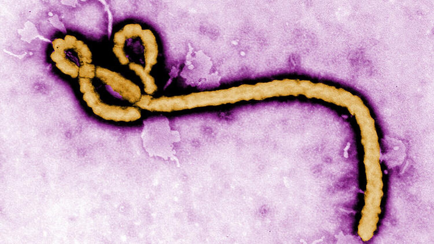 Prof. Dr. Stephan Becker (UMR)  und weitere Expert*innen ordnen Ebola-Ausbruch ein